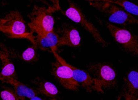 3. ábra. RT-PCR elemzéssel igazoltuk, hogy a BCE és BAEC sejtek expresszálják a bfcrn gént. Pozitív kontrollként a Mac-T sejtekbıl (bovine mammary acinus epithelial sejtvonal) izoláltunk total RNS-t.