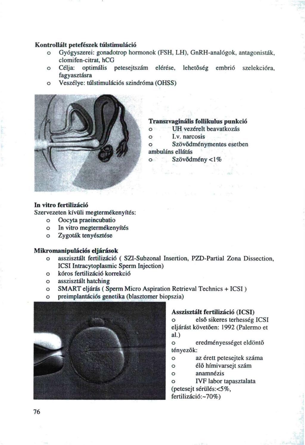 Kntrllált petefészek túlstimuláció Gyógyszerei: gnadtrp hrmnk (FSH, LH), GnRH-analógk, antagnislák, clmifen-citrat, hcg Célja: ptimális petesejtszám elérése, lehetőség embrió szelekcióra,