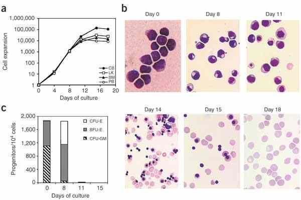 Large-scale production of red blood cells from stem cells: What are the technical