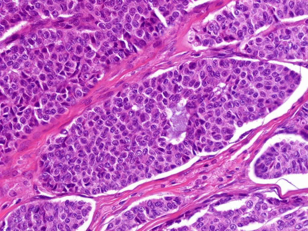 Granulosa sejtes komponens Call-Exner test: