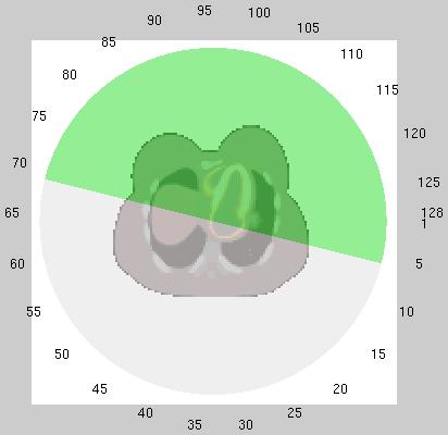 (a) sematikus ábrázolás (b) polar map 5.11. ábra. A becslés eredménye. A kiválasztott szkennelési tartomány (zöld terület) az elnyelés térkép alapján került kiválasztásra Gauss-os súlyozással a(z) (5.