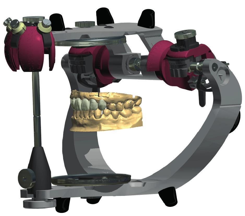 A HappySmile-kezelés hátteréről TECHNIKAI KISOKOS Szoftver A rendszer alapja egy 3D fogmozgató szoftver, a 3Shape dániai székhelyű cég OrthoAnalyzer terméke.