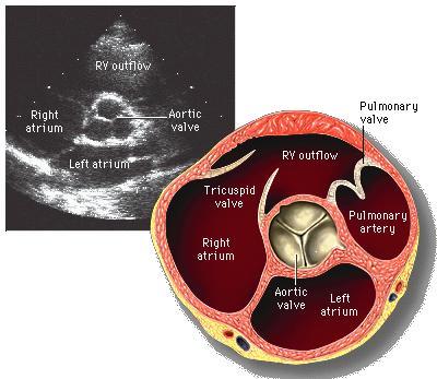 Aorta-