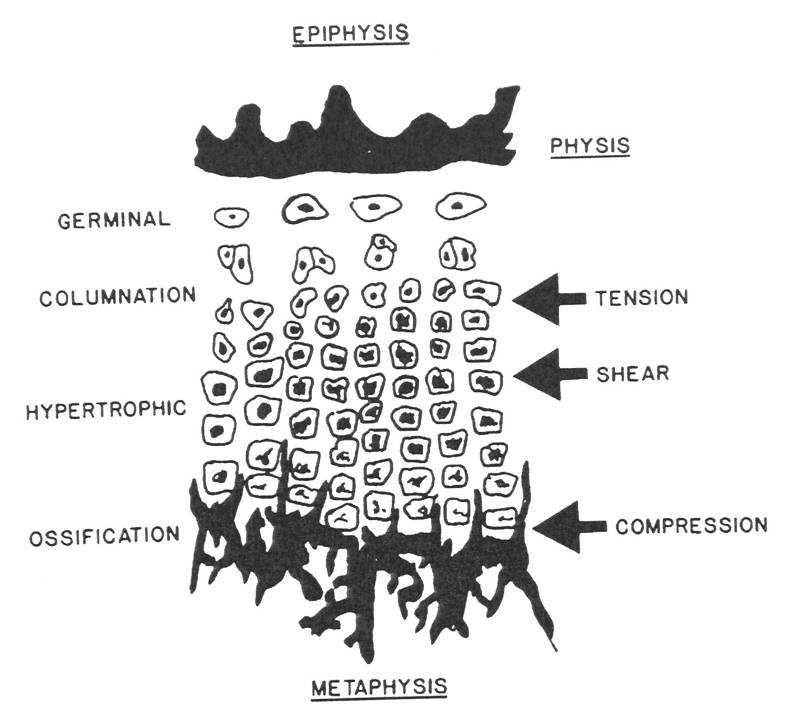 Az erıhatások tipusának megfelelıen en érzékeny szövettani régiók k a physisben EPIHYSIS