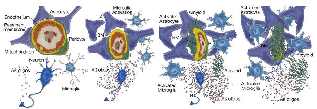 A -Amyloid