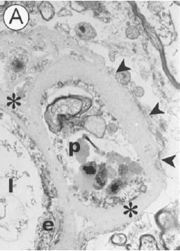 Luiten, Progr Neurobiol,