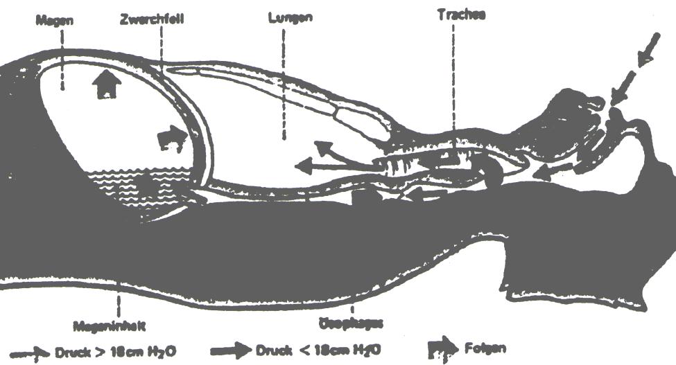 tubushelyzet ellenőrzése OK? - Sellick felengedhető Sellick B.A.: Lancet 2:404-6. 1961. Herman et al (1966) Aspiratio CP ellenére Meck T (1999) Helyes techika? Schmidt A.