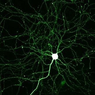 : csigolyaközti dúcok érző neuronjai) BIPOLÁRIS (kétnyúlványú): egy