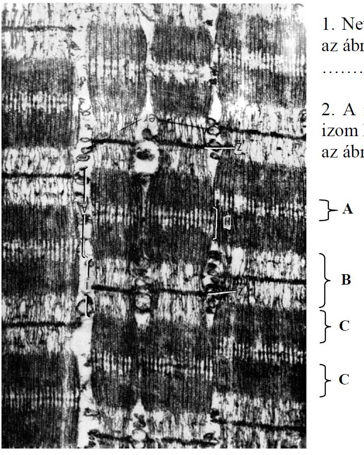 Az izomműködés Emelt szintű érettségi feladatok Az ábrán egy gerinces izom izomfonalainak elektronmikroszkópos képét figyelheti meg. 1. Nevezze meg, melyik izomszövet típust látjuk az ábrán!. 2.