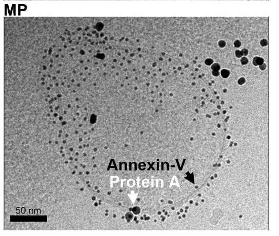 Ig és PS kimutatása cryo-tem módszerrel (protein A-conjugated gold nanoparticles (10 nm)