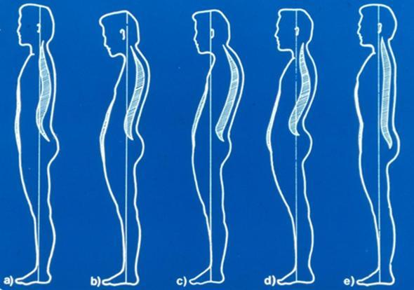 A nyaki és az ágyéki gerinc előre, a mellkasi és a keresztcsonti gerinc hátrafelé görbül. Az egsézséges felnőtt ember gerince kétszeres S alakban görbült és ezek a görbületek egymást kiegyenlítik.
