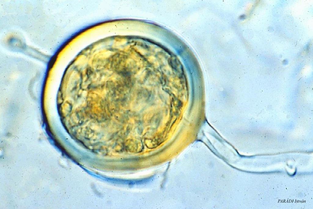 AM gombaspóra (Glomus sp.