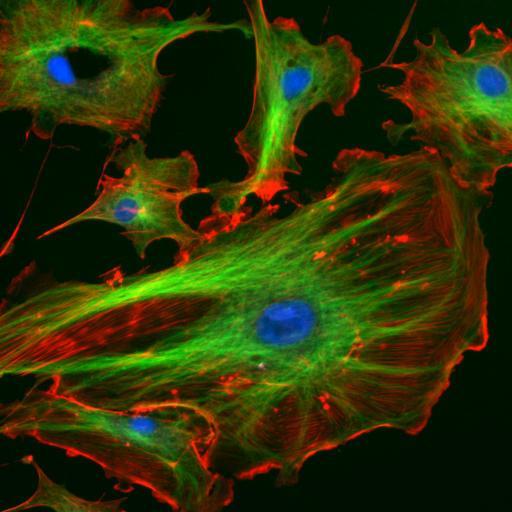 folyadék-mozaik modell) ostor RER SER centromer sejtmag maghártya sejtmagvacska kromatin