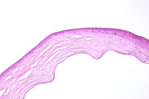 Az epithelium hiperpáziás