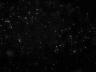 ábra jól szemlélteti, hogy az egészségügyben is kockázatot jelentő MRSA biofilmet a kakukkfűolaj hogyan
