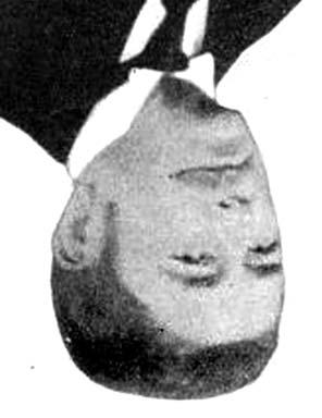 DR. BARTOS GÁBOR ÉS MTSAI. 24. ábra. Hüttl Hümér (868-940) végzett, autoplasticus és homoioplasticus érpótlással kapcsolatos eredményeit (48).