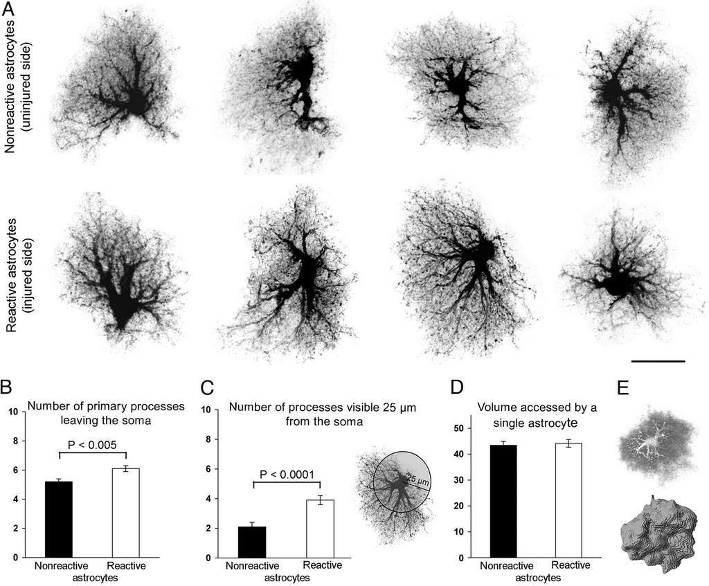 Wilhelmsson, Pekny et al 2006 Glia- patofiziológia Reaktív gliózis 4 nappal
