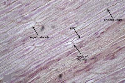 http://neuropathologyweb.