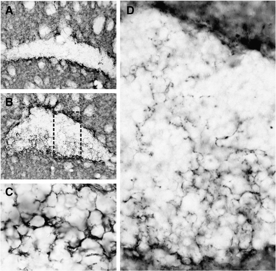 Wallerian degeneration - CNS-ben is van valamiféle axon-regeneráció : axon-sprouting Representative photomicrographs of sprouting dopaminergic (DAT, dopamine transporter) fibres in A) Wound region of