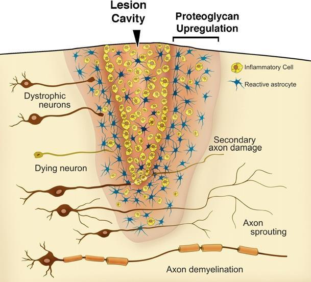 Wallerian degeneration CNS - fontos kérdéskör: proinflammatorikus és anti-inflammatorikus anyagok szekréciója mikroglia/makrofágok által : neurotoxikus vs neuroprotektív folyamatok!