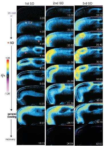 Spreading depression Intrinsic optical imaging Light transmittance (LT) changes measured in a coronal slice of rat neocortex in response to successive 1.