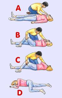 RECOVERY POSITION 1. a beteg felénk eső karját könyökben behajlítva az arc mellé helyezzük 2.