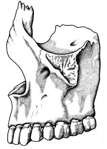 Pl.: Tuberális