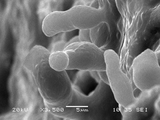 PHD TÉZISEK nyilvános vitára BIOMINERALIZÁCIÓ HATÁSA PORÓZUS DURVA MÉSZKŐRE Juhász Péter okl.