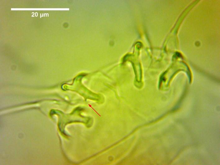 Small point on one of the posterior claws of IV. leg pair (1.