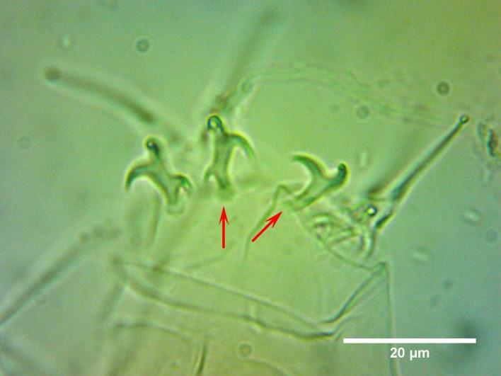 ); Figure 12. Small point on one of the posterior claws of IV.