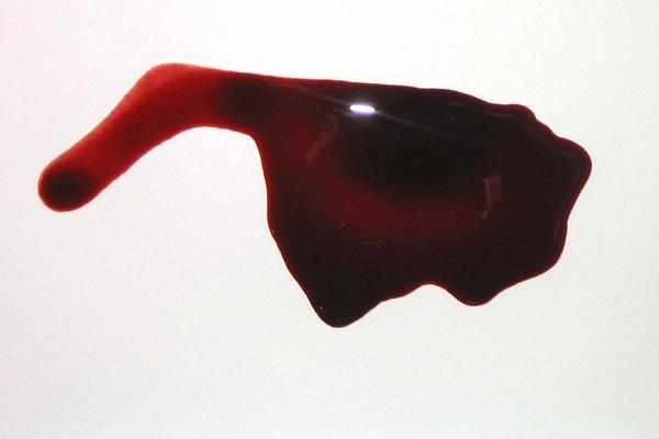 kép Tócsa, vízszintes felületen meggyűlő, cseppnél nagyobb