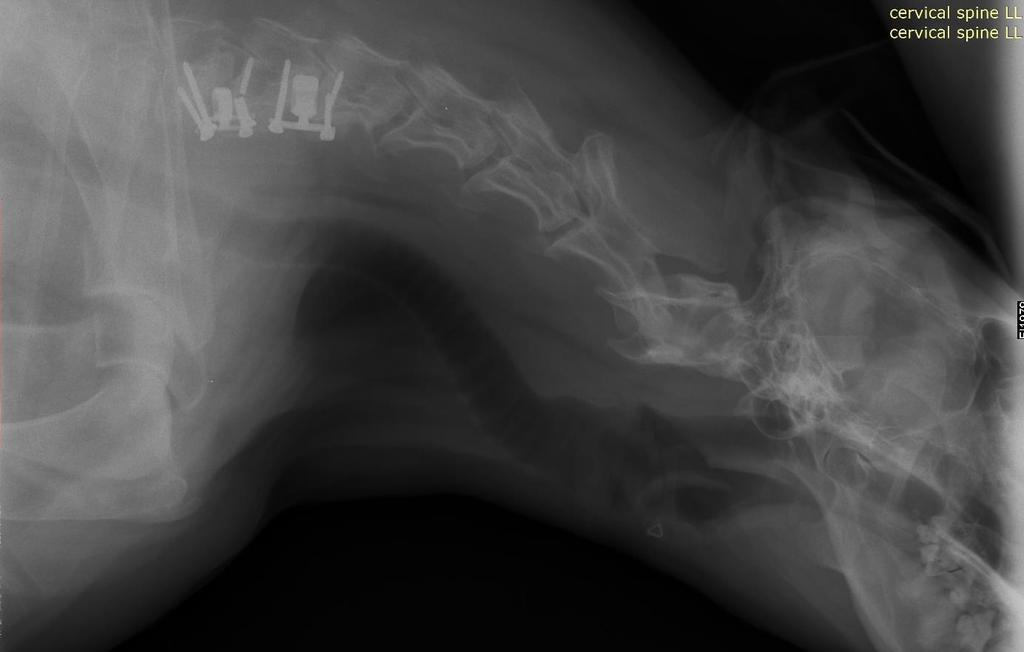 20. ábra: Kontroll röntgen, Rozi (Forrás: Fehér Egér kisállatkórház, röntgenarchívum) A 4-es számú beteg, Bíbor állapota a tünetek kialakulása és a műtét között eltelt egy-másfél hónap, valamint az