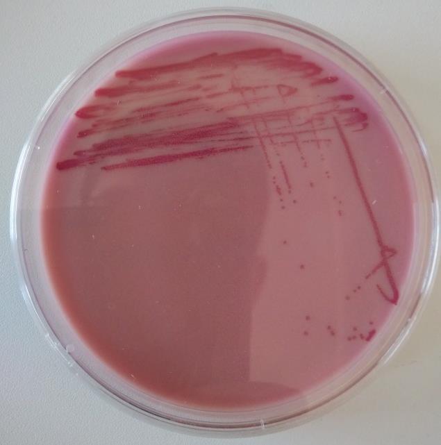 médium szintén két kromogén rendszert használ, melyek során a Salmonella α-galaktozidáz termelését is viszgálja.