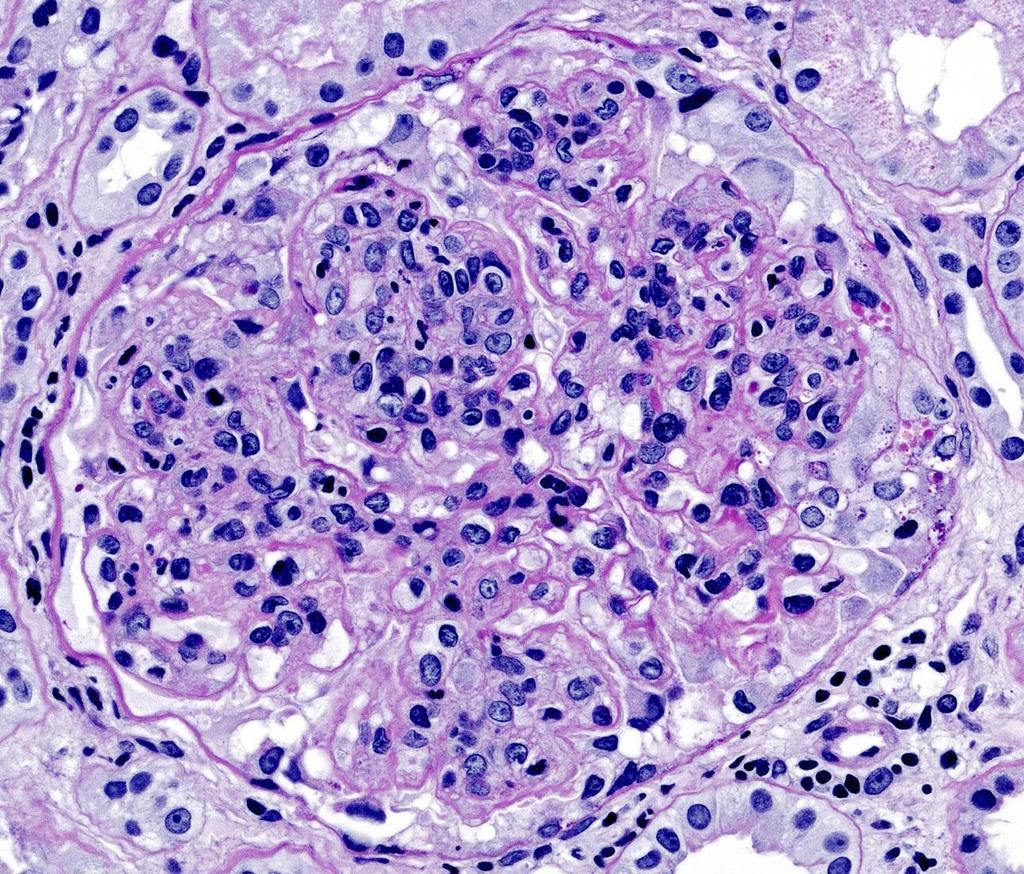 Endocapillaris és