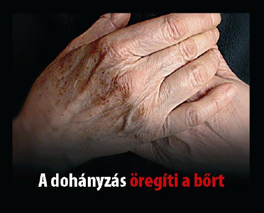 36. M) A dohányzás