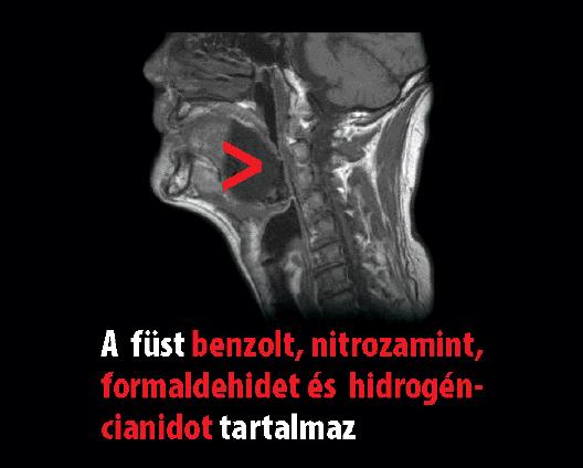 nitrózaminokat,
