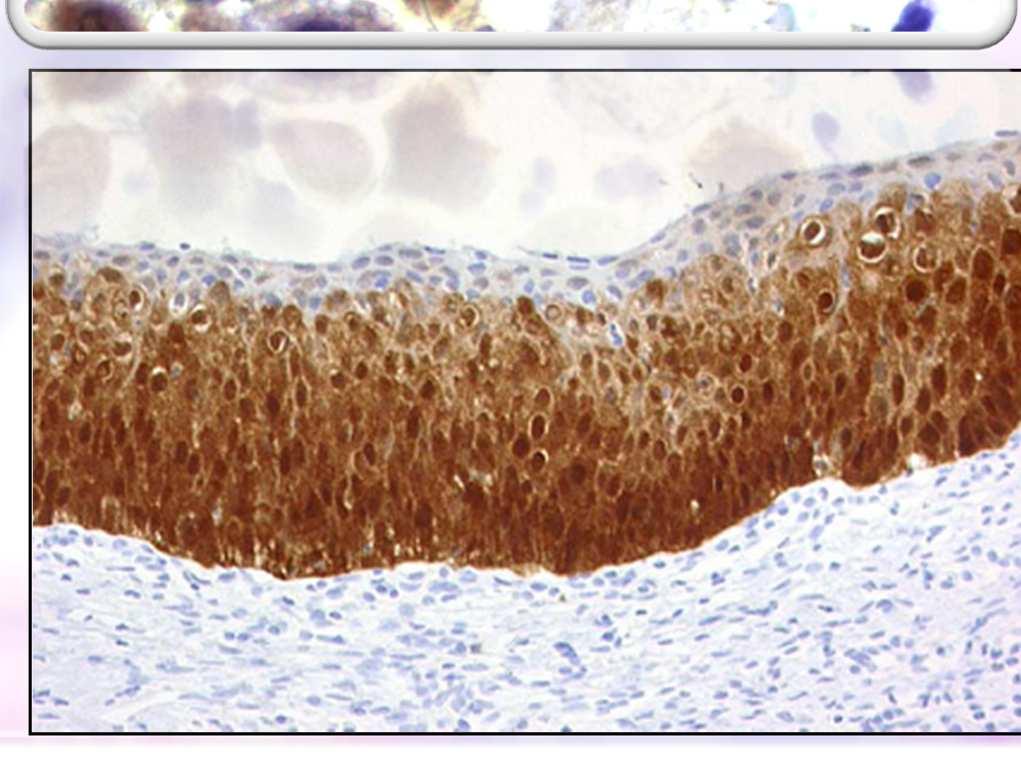 progressziós marker cytologiai