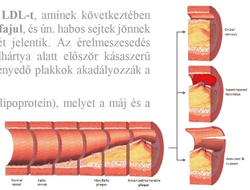 A VLDL a kilomikronhoz hasonló módon VLDLremnanttá alakul, csökken a zsírsavtartalma és megváltozik a fehérje-összetétele is, és így kialakul az elsősorban koleszterint szállító LDL.