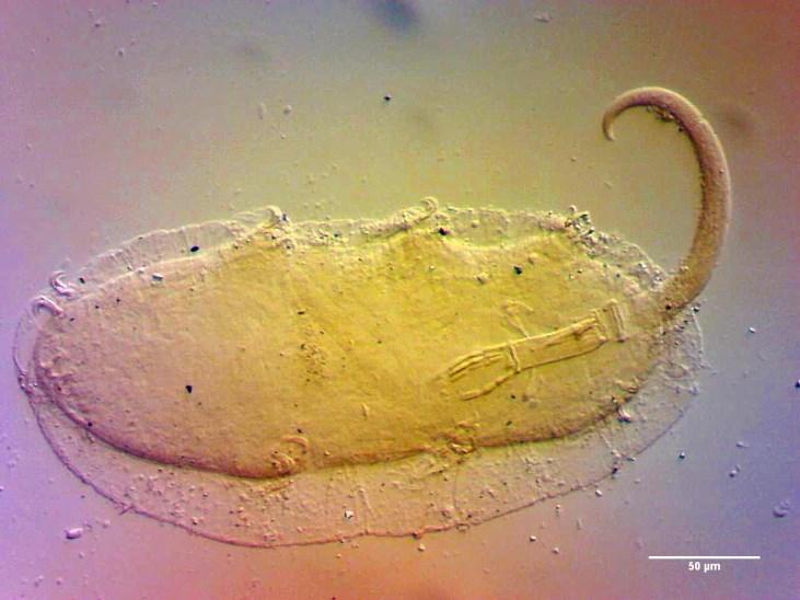 e Acta Naturalia Pannonica 8 (2015) 127 1. ábra. Paramacrobiotus richtersi zsákmányol egy fonálférget 1. figure. Paramacrobiotus richtersi captured a nematode 2.