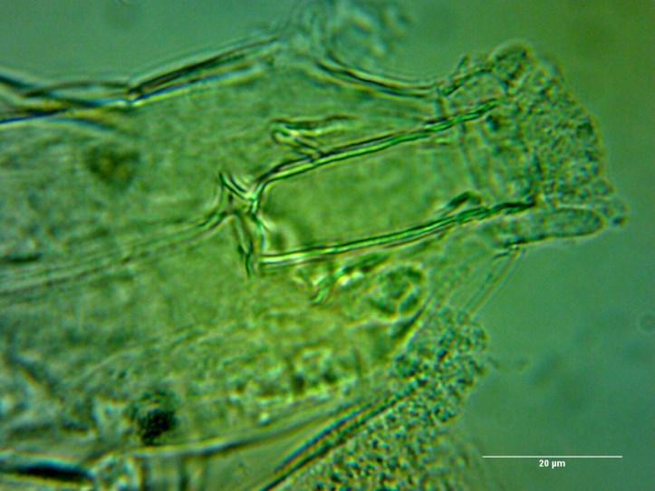 figure. Herbivore species (Hypsibius convergens) 4. ábra. Mikroba-fogyasztó faj (Adropium scoticum) (fotók: Vargha B.) 4. figure.