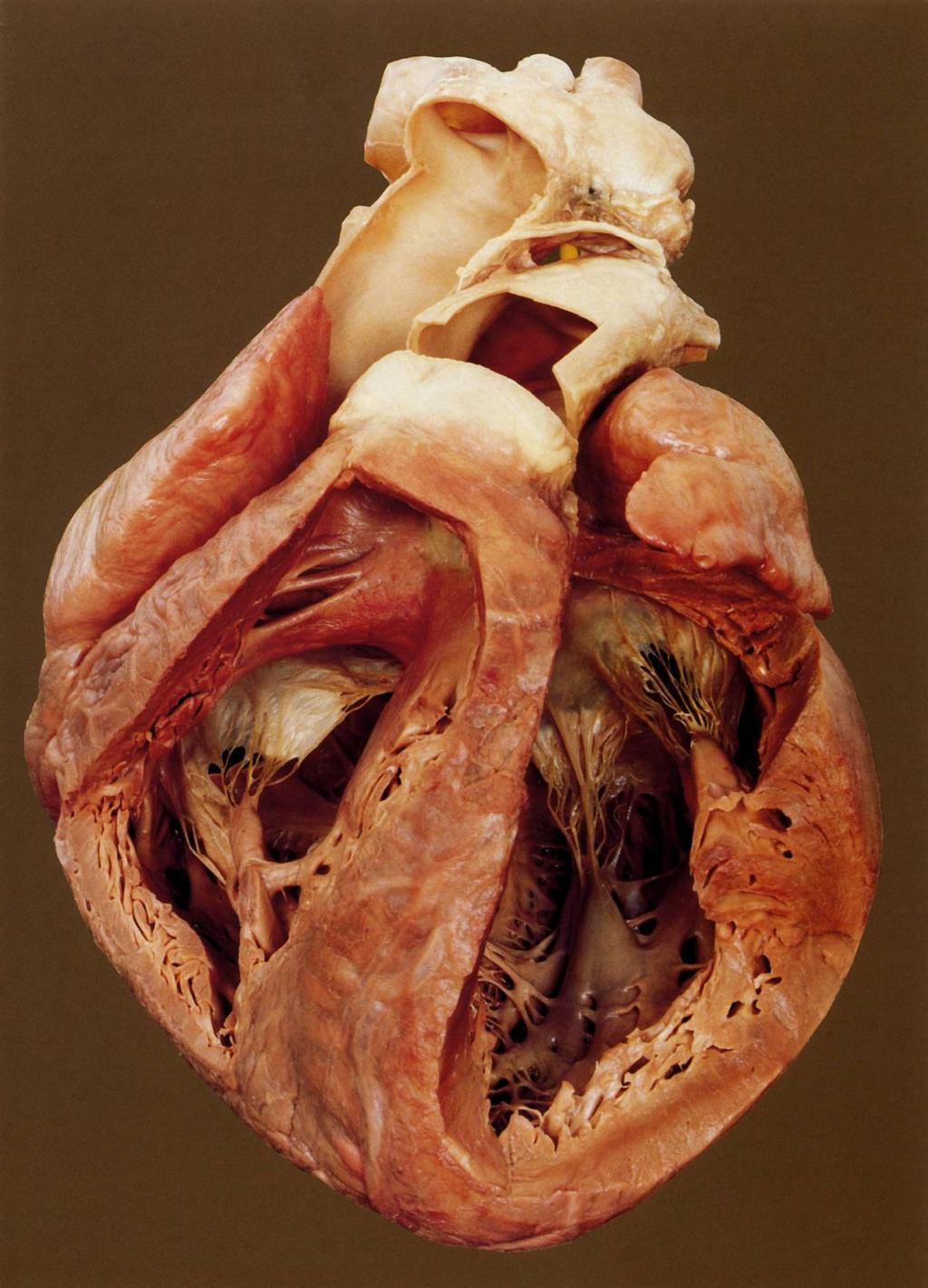 A szív v kamrái: ventriculus dexter, ventriculus sinister A A kék k k nyíl l a truncus pulmonalisban,, a piros nyíl l az aorta szájad jadéka felé mutatja a véráramlás s irány nyát.