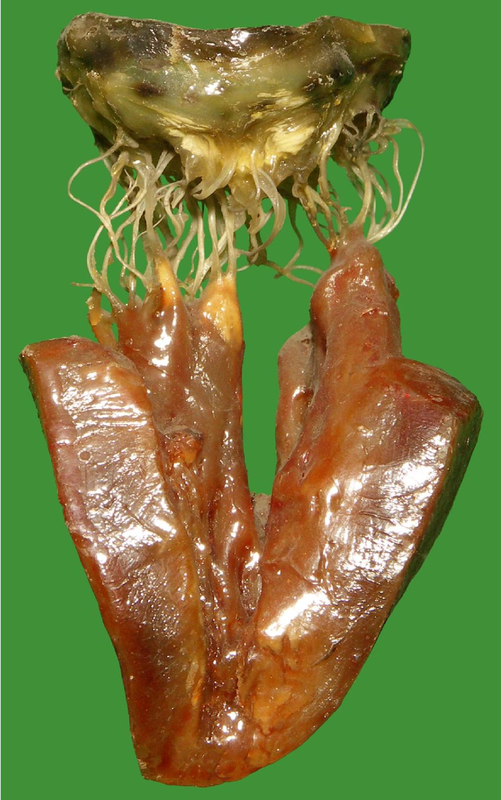 CUSPIS: endocardium kettőzet és s kevés s kötőszk szövet Chordae tendineae: endocardium és s kevés kötőszövet Musculus papillaris: kamrai szívizom A vitorlás s billentyűk k