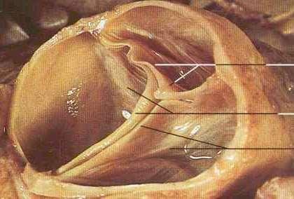 A zsebes billentyűk A szív zsebes billentyűi a kamrák és az artériák határán találhatók (zsebes