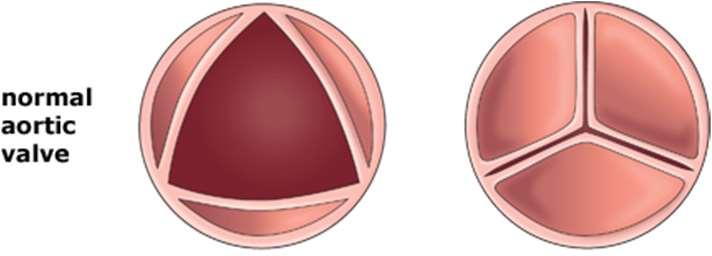 Ha a kamrákban nagyobb a nyomás, mint az artériákban, akkor összelapulva megnyílnak.