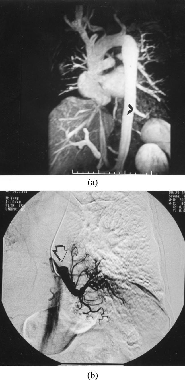 Cardiovascular and