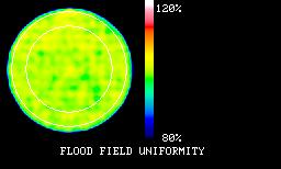 Minőség ellenőrzés/biztosítás (Quality Control, QC) UFOV (Useful Field Of View), CFOV (Central Field Of View) Érzékenység : A kamerát érő impulzusok hány százalékát képes érzékelni Minőség