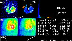 Fázis és amplitúdó kép Az EKG kapuzott vizsgálat esetén minden pixel érték periodikusan változik, tehát Fourier sorba fejthető. Legyen F k a sorozat k.