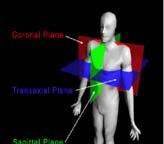rekonstrukció Projekciók transzverzális metszetek 3D adatok (X, Y, Z) bal sodrású koordináta rendszer X: jobb bal, Y: elől hátul, Z: fej láb A metszetek sorrendje: (X, Y) transzverzális: fej láb (X,