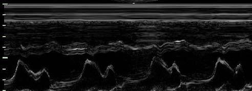 e c (t) = K R(x, y, z) S(x, y) p(t 2z/c) dx dy dz A scan: Ha S az origó körüli kis kör, és p(t) rövid, akkor az integrál t-beli értékét R -nek csak a (0, 0, ct/2) pont környékén felvett értéke