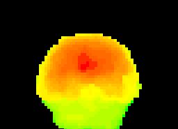 Felület megjelenítés (SPECT) DISTmozi.gif Máté: Orvosi képalkotás 223 Felület megjelenítés (4D UH) UH4D.